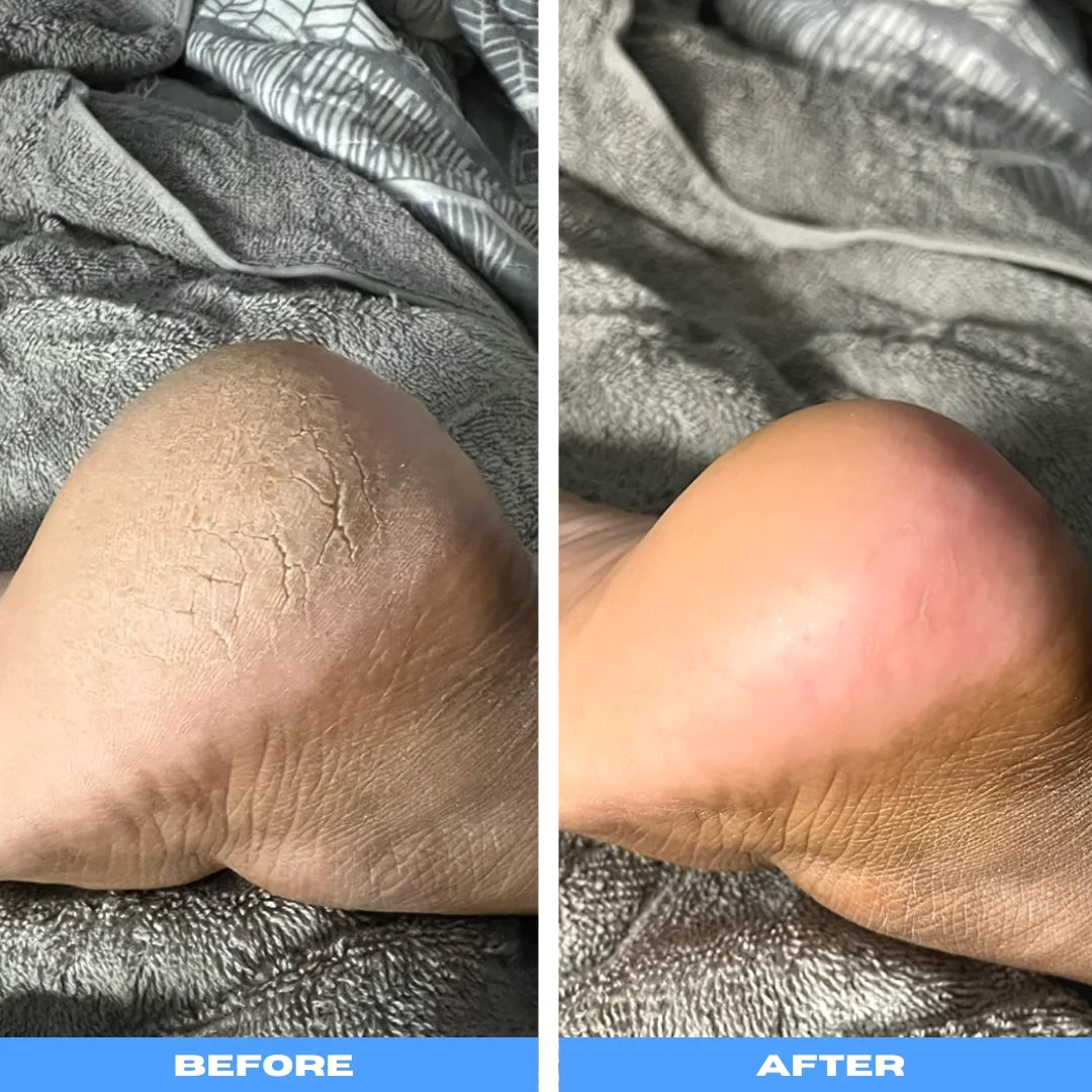 SmoothSteps™ Electric Pedicure Wand