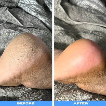 SmoothSteps™ Electric Pedicure Wand